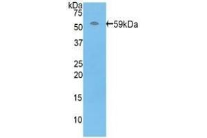 Detection of Recombinant PRF1, Human using Polyclonal Antibody to Perforin 1 (PRF1) (Perforin 1 anticorps  (AA 32-316))
