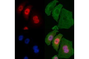 ABIN6255512 and ABIN6267316 staining Hela cells by IF/ICC.