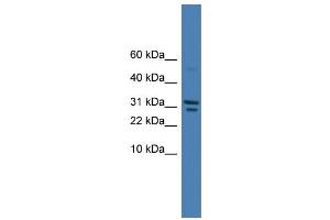 WB Suggested Anti-SPINT2 Antibody Titration: 0. (SPINT2 anticorps  (C-Term))