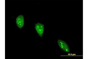 Immunofluorescence of monoclonal antibody to ANGPTL7 on HeLa cell. (ANGPTL7 anticorps  (AA 27-126))