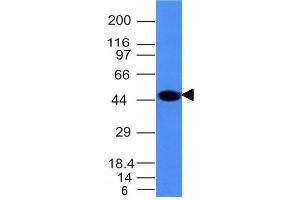 Western Blot Analysis of A431 cell lysate using Cytokeratin 8 Mouse Monoclonal Antibody (H1).