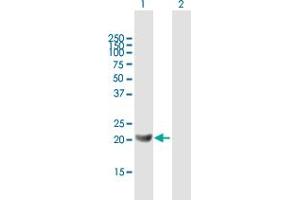 Western Blot analysis of GM2A expression in transfected 293T cell line by GM2A MaxPab polyclonal antibody. (GM2A anticorps  (AA 1-193))