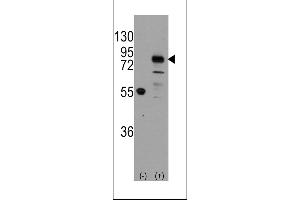 Western blot analysis of CDH9 using rabbit polyclonal CDH9 Antibody using 293 cell lysates (2 ug/lane) either nontransfected (Lane 1) or transiently transfected with the CDH9 gene (Lane 2). (Cadherin 9 anticorps  (C-Term))
