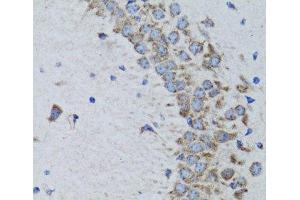 Immunohistochemistry of paraffin-embedded Rat brain using PTPN1 Polyclonal Antibody at dilution of 1:100 (40x lens). (PTPN1 anticorps)