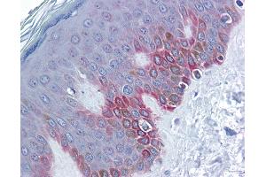 Immunohistochemistry (IHC) image for anti-Frizzled Family Receptor 5 (FZD5) (Middle Region) antibody (ABIN2776705)