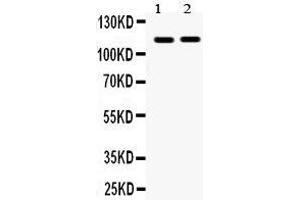Observed bind size: 114KD (EPH Receptor A5 anticorps  (C-Term))