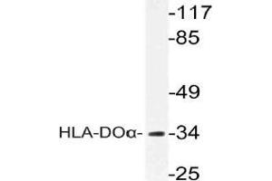 Western blot (WB) analysis of HLA-DOalpha antibody in extracts from COLO cells.