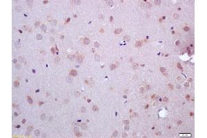Formalin-fixed and paraffin embedded rat brain labeled with Anti-ARHI Polyclonal Antibody, Unconjugated (ABIN681448) at 1:200 followed by conjugation to the secondary antibody and DAB staining