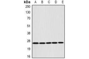Western blot analysis of DIRAS3 expression in NIH3T3 (A), mouse liver (B), mouse brain (C), rat liver (D), rat kidney (E) whole cell lysates.