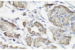Immunohistochemistry of paraffin-embedded Human stomach using WASF3 Polyclonal Antibody at dilution of 1:100 (40x lens). (WASF3 anticorps)
