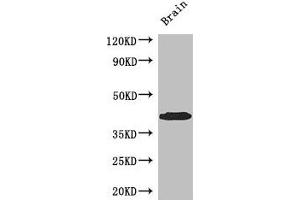 Western Blot Positive WB detected in: Mouse brain tissue All lanes: SPDEF antibody at 3 μg/mL Secondary Goat polyclonal to rabbit IgG at 1/50000 dilution Predicted band size: 38, 36 kDa Observed band size: 38 kDa (SPDEF/PSE anticorps  (AA 145-247))