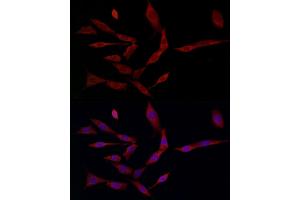 Immunofluorescence analysis of HepG2 cells using Ferritin Heavy Chain Rabbit pAb (ABIN3021538, ABIN3021539, ABIN3021540 and ABIN6215218) at dilution of 1:200 (40x lens).
