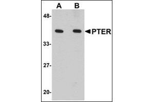 Western blot analysis of PTER in human kidney tissue lysate with this product at (A) 1 and (B) 2 μg/ml. (PTER anticorps  (C-Term))