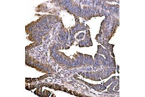 IHC analysis of HIP1R using anti-HIP1R antibody (ABIN7601290).