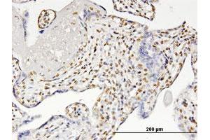 Immunoperoxidase of monoclonal antibody to RUNX2 on formalin-fixed paraffin-embedded human placenta. (RUNX2 anticorps  (AA 251-350))