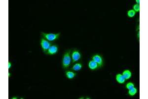 Immunofluorescent staining of HT29 cells using anti-AK1 mouse monoclonal antibody (ABIN2452270). (Adenylate Kinase 1 anticorps)