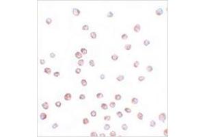 Immunocytochemistry of SCUBE1 in Daudi cells with SCUBE1 antibody at 20 μg/ml.