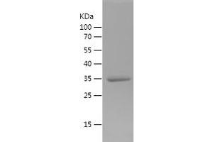 Western Blotting (WB) image for Macrophage Migration Inhibitory Factor (Glycosylation-Inhibiting Factor) (MIF) (AA 2-115) protein (His-IF2DI Tag) (ABIN7123822)
