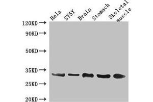 Western Blot Positive WB detected in: Hela whole cell lysate, SH-SY5Y whole cell lysate, Mouse brain tissue, Mouse stomach tissue, Mouse skeletal muscle tissue All lanes: GJB3 antibody at 3 μg/mL Secondary Goat polyclonal to rabbit IgG at 1/50000 dilution Predicted band size: 31 kDa Observed band size: 31 kDa (Connexin 31 anticorps  (AA 211-270))
