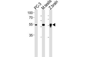 Western Blotting (WB) image for anti-DMRT-Like Family A2 (DMRTA2) antibody (ABIN3001241) (DMRTA2 anticorps)