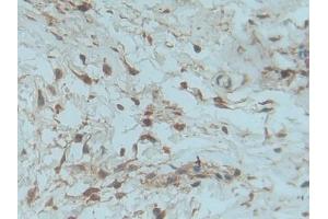 Used in DAB staining on fromalin fixed paraffin- embedded kidney tissue (PDGF-BB Homodimer (AA 82-190) anticorps)