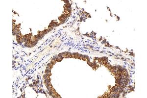 Immunohistochemistry analysis of paraffin-embedded mouse lung using CK-8 Polyclonal Antibody at dilution of 1:200. (KRT8 anticorps)