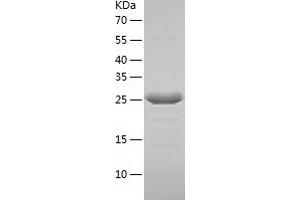 Western Blotting (WB) image for General Transcription Factor IIE, Polypeptide 2 (GTF2E2) (AA 1-291) protein (His tag) (ABIN7123075)