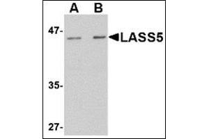 Western blot analysis of LASS5 in rat brain tissue lysate with this product at (A) 1 and (B) 2 μg/ml. (LASS5 anticorps  (N-Term))
