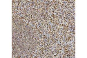 IHC analysis of VPS53 using anti-VPS53 antibody (ABIN7599731). (VPS53 anticorps  (AA 11-699))