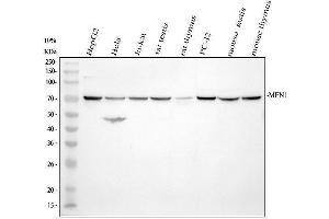 Western blot analysis of MEN1 using anti-MEN1 antibody (ABIN7599497).