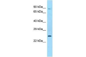 Western Blotting (WB) image for anti-Sex Hormone Binding Globulin (SHBG) (N-Term) antibody (ABIN2789332) (SHBG anticorps  (N-Term))