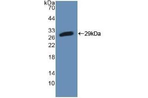 Detection of Recombinant PFKP, Mouse using Polyclonal Antibody to Phosphofructokinase, Platelet (PFKP) (PFKP anticorps  (AA 247-473))