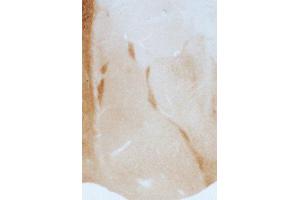 Immunostaining of rat amygdala showing labeling of GABAA α3 subunit. (GABRA3 anticorps  (N-Term))