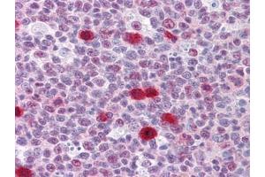 Immunohistochemistry (IHC) image for anti-TSC22 Domain Family, Member 3 (TSC22D3) (AA 1-98) antibody (ABIN614600)