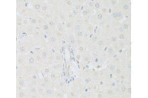 Immunohistochemistry of paraffin-embedded Rat liver using KAT2A Polyclonal Antibody at dilution of 1:100 (40x lens). (KAT2A anticorps)