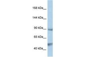 Image no. 1 for anti-Protein tyrosine Phosphatase, Non-Receptor Type 3 (PTPN3) (AA 106-155) antibody (ABIN6747346) (PTPN3 anticorps  (AA 106-155))