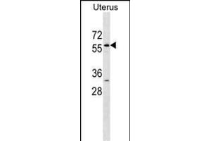 LEMD2 Antibody (N-term) (ABIN1538922 and ABIN2838288) western blot analysis in Uterus tissue lysates (35 μg/lane). (LEMD2 anticorps  (N-Term))