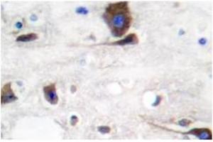 Image no. 1 for anti-Neuregulin 1 (NRG1) antibody (ABIN265466) (Neuregulin 1 anticorps)