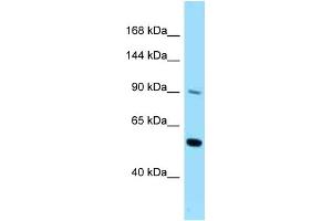 WB Suggested Anti-CSF2RB Antibody Titration: 1. (CD131 anticorps  (C-Term))