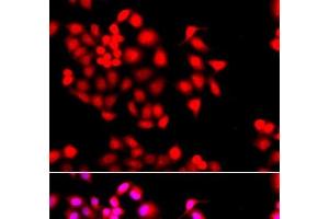 Immunofluorescence analysis of A549 cells using STXBP2 Polyclonal Antibody (STXBP2 anticorps)