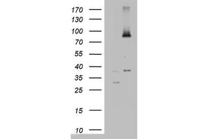 Western Blotting (WB) image for anti-ATP-Binding Cassette, Sub-Family D (Ald), Member 1 (ABCD1) (AA 508-745) antibody (ABIN2715621) (ABCD1 anticorps  (AA 508-745))