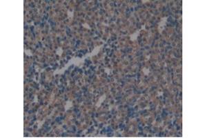 Detection of ARG in Rat Kidney Tissue using Monoclonal Antibody to Arginase (ARG) (ARG anticorps  (AA 1-323))