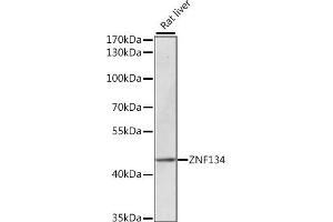 Western blot analysis of extracts of rat liver, using ZNF134 antibody (ABIN7271455) at 1:1000 dilution. (ZNF134 anticorps  (AA 100-180))