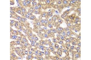 Immunohistochemistry of paraffin-embedded Rat liver using UGDH Polyclonal Antibody at dilution of 1:100 (40x lens). (UGDH anticorps)