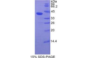 SDS-PAGE analysis of Human BMP10 Protein. (BMP10 Protéine)