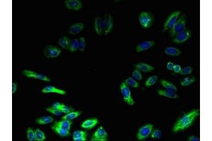 anti-Transmembrane Protein 217 (TMEM217) (AA 150-211) antibody