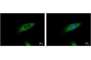 Image no. 3 for anti-Huntingtin Interacting Protein 1 Related (HIP1R) (N-Term) antibody (ABIN1494032)
