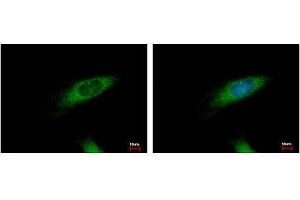 Image no. 3 for anti-Huntingtin Interacting Protein 1 Related (HIP1R) (N-Term) antibody (ABIN1494032) (HIP1R anticorps  (N-Term))