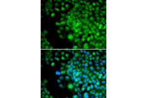 Immunofluorescence analysis of HeLa cells using FHL1 antibody.