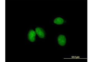 Immunofluorescence of purified MaxPab antibody to KCTD18 on HeLa cell. (KCTD18 anticorps  (AA 1-426))